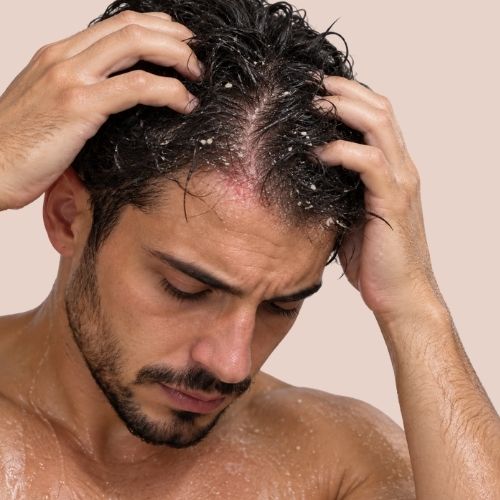 Scalp care